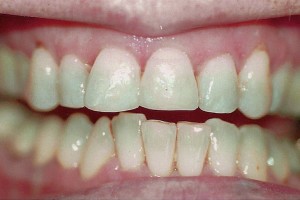 1afterpic