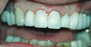 2afterpic
