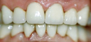 4afterpic