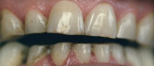 4beforepic