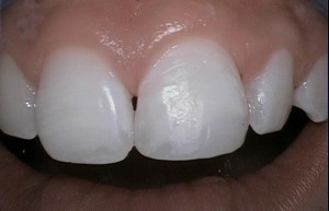 5afterphoto_edited-1