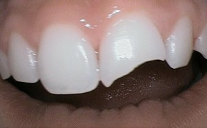 5beforepic